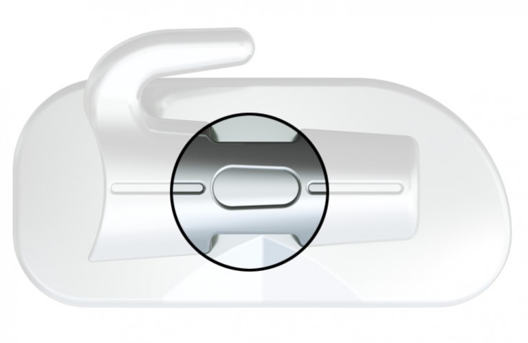 Positioning GuideMakes bonding easier at the posterior.